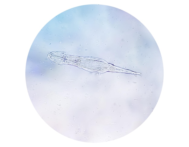 Schistosoma Haematobium-parasiet in menselijk urinemonster onder microscoop. Urine parasiet.