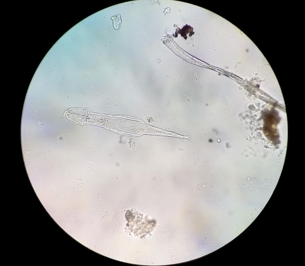 Photo schistosoma haematobium parasite in human urine specimen under microscope