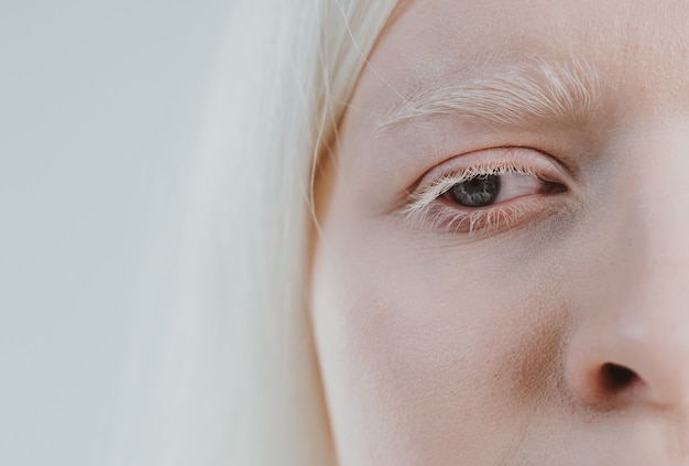 schoonheidsbeeld van een albino-meisje dat in de studio poseert en lingerie draagt