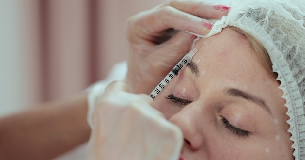 Schoonheidsspecialist maakt botox-injectie in het voorhoofd. schoonheidsspecialiste in handschoenen houdt een spuit klaar om schoonheidsinjectie in vrouwelijk voorhoofd te maken.