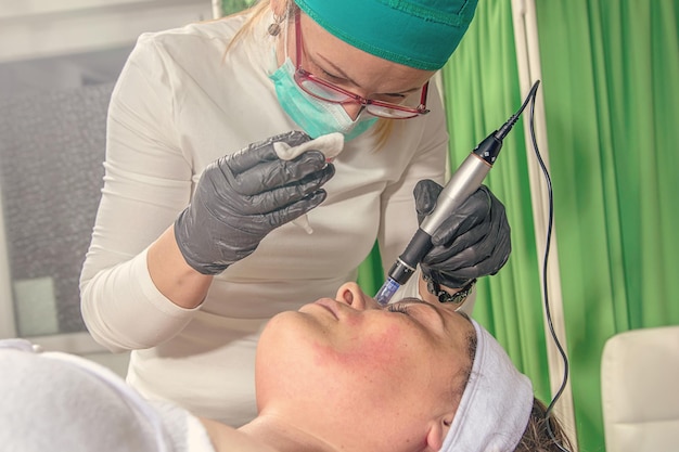 Schoonheidsspecialiste voert een mesotherapie-behandeling met naalden uit op het gezicht van een vrouw.