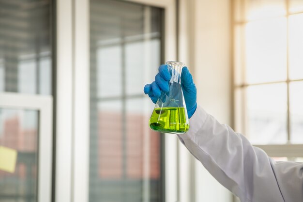 Scienza e concetto di assistenza sanitaria. primo piano della mano di scienziati dottori che tiene in mano una boccetta di sostanze chimiche liquide verdi in un laboratorio.