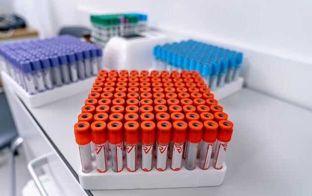 Scientific chemistry researchment technology mpty blood test tubes in laboratory