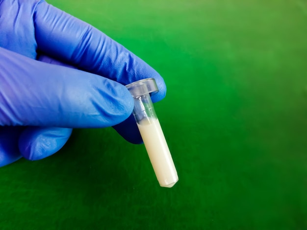 Scientist or Biochemist hold test tube with Lipemic blood sample. High Triglyceride contain serum.