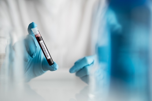 写真 covid-19またはコロナウイルスのラベルが付いた血液試験管を保持している科学者、パンデミック薬を発明するための臨床検査
