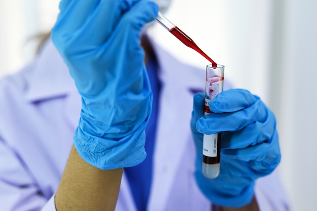 Ученый, имеющий коронавирусную инфекцию Ковид-19, пробирку для анализа крови, анализ ДНК крови в лаборатории