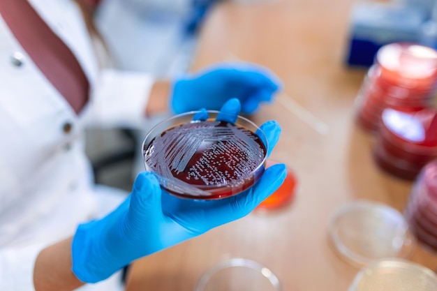 Photo scientist holding a petri dish with bacterial clones female lab technician working with strains of bacteria grown in petri dishes