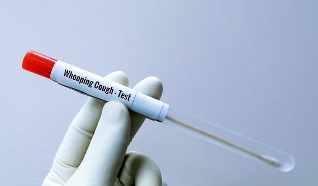 Scientist holding swab sample for whooping cough test, a disease by Bordetella pertussis bacteria.