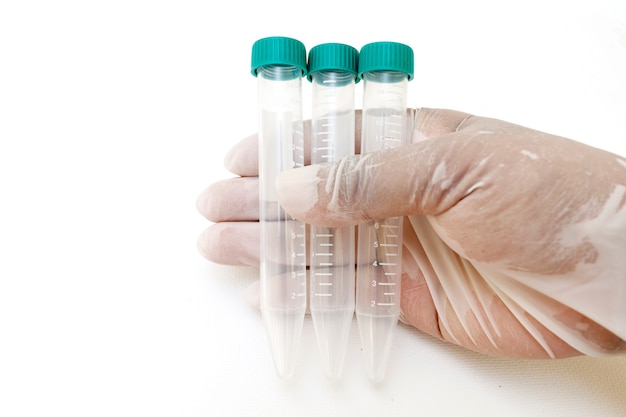 Scientist holding test tube empty For the experiment blood samples