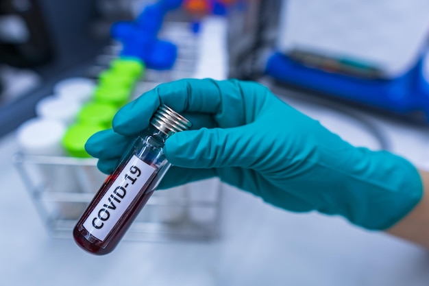 Scientist holding Test tube with blood sample for COVID19 testExperiment to detect virus was found in the bloodDevelopers of potential medicines and vaccines against COVID19