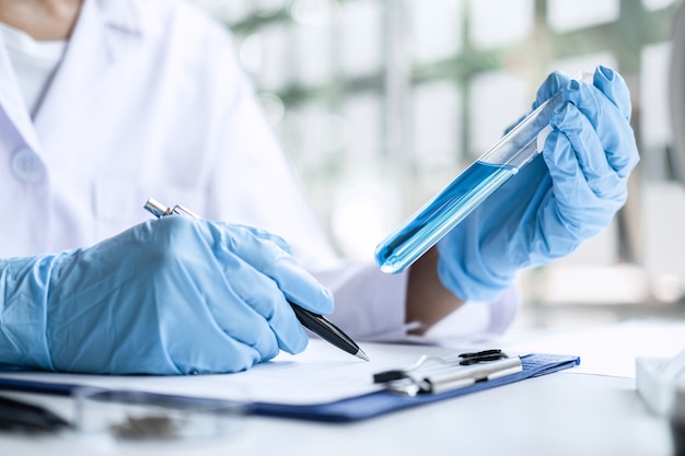 Scientist or medical in lab coat holding test tube with reagent