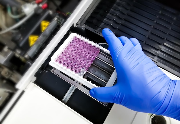 Scientist set Enzyme Linked Immunosorbent Assay or ELISA plate for taking optical density
