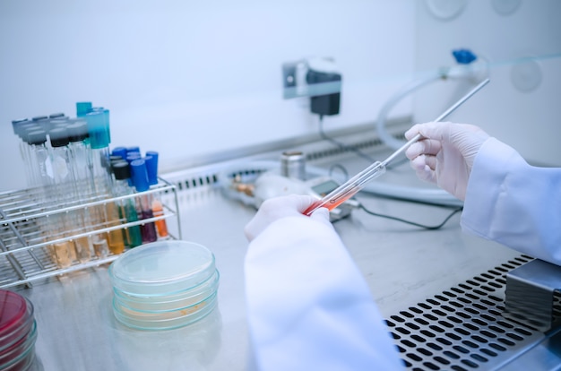 Photo scientist used chemical solution and equipment lab testing for bacteria