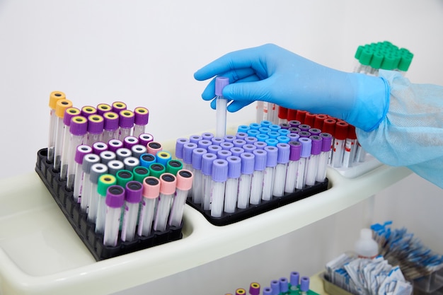 Scientist working with blood sample in laboratory