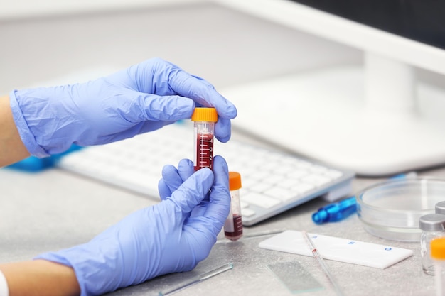 Scientist working with blood sample in laboratory