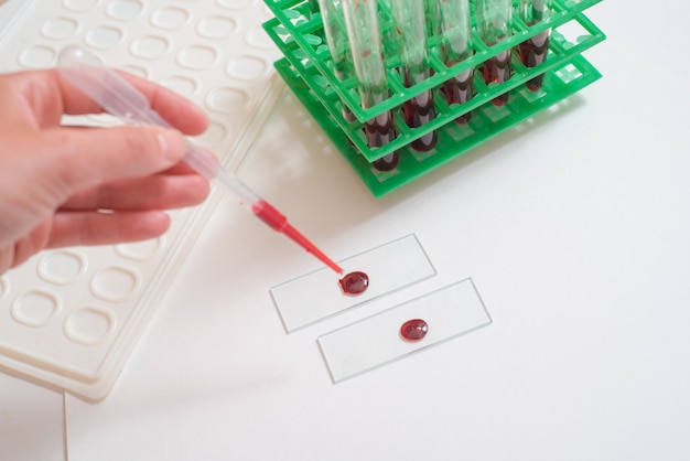 Scientist working with blood sample in laboratory