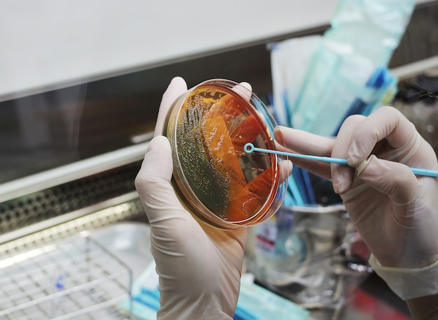 Photo scientists are holding a bacterial culture plate.