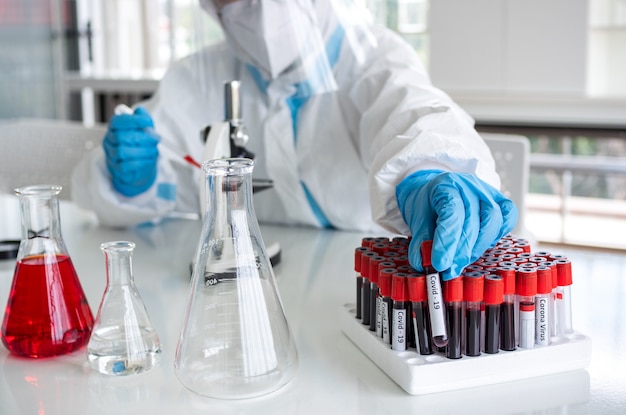 Scientists and microbiologists with PPE suit and face mask hold test tube with blood collected from patients covid19, to create vaccine for coronavirus.