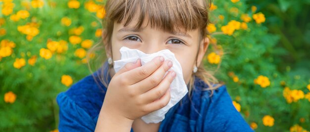 Seasonal allergy in a child.