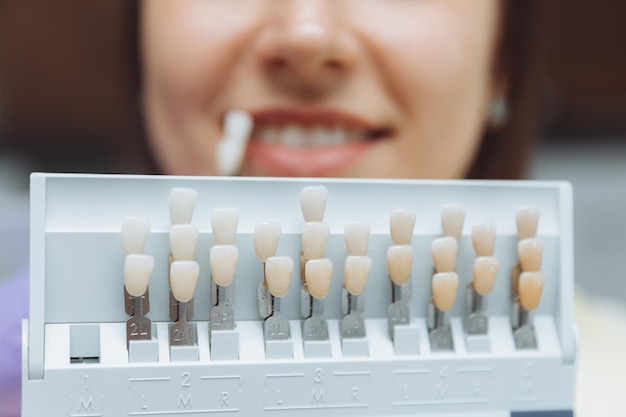 Foto selectie van de juiste tandkleur voor professioneel cosmetisch bleken bij de tandarts de arts selecteert de tanden voor de patiënt