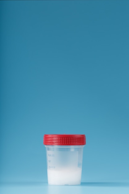 semen in a test container with a red lid on blue