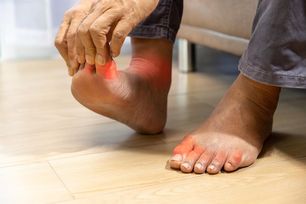 Senior Man massage foot with painful swollen gout inflammation