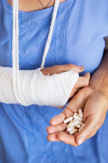 Photo a senior retired woman with a rewound arm in a cast and a bandage holds anesthetic pills. blow, fracture, bones, hospital.