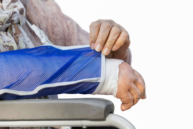 Senior woman with a broken arm on a plaster cast