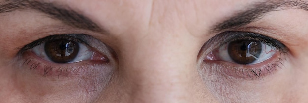 Senior woman with dark brown eyes and wrinkles closeup eyesight health checkup concept