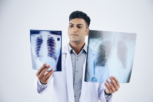 Serious young indian doctor comparing two chest x-rays of patient, isolated on white