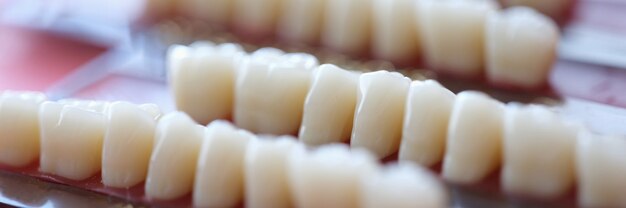 Набор зубных протезов находится на столе в концепции стоматологического кабинета