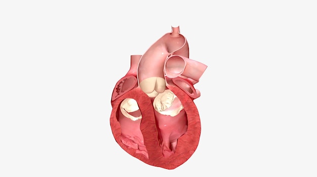 Several heart conditions can cause the septum of the heart to thicken