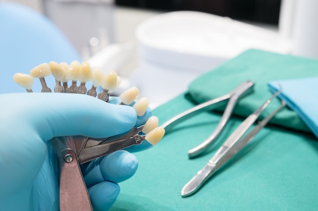 Guida dello schermo per il controllo del colore della corona del dente in clinica.