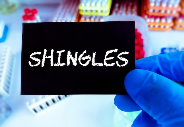 SHINGLES medical term. Medical conceptual image.