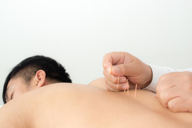 Photo shirtless man getting acupuncture treatment at hospital