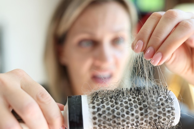 Shocked woman looks at her comb with a lot of hair