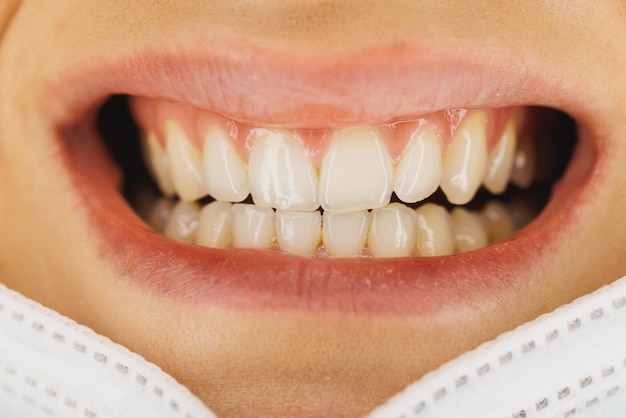 Shot of an unrecognisable woman smiling brightly with teeth before having orthodontist or dental work done.