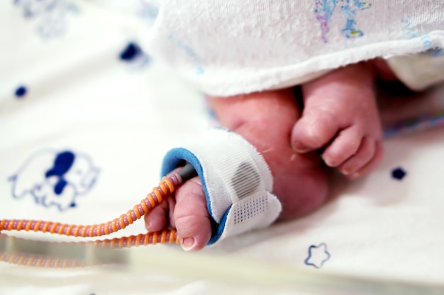 Foto piede del neonato malato inserire un cinturino per misurare l'ossigeno nel sangue e vedere il valore di ossigeno per gli organi.