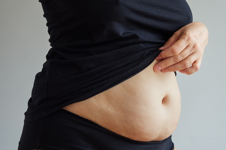 Photo side view of a woman in black underwear with excess fat on her stomach