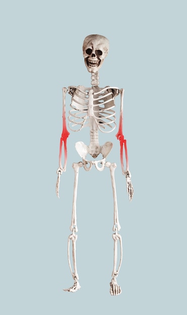 Skelet met elleboogpijn botziekte concept