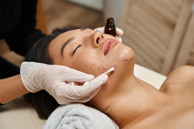 Terapeuta di cura della pelle che applica siero con un tampone di cotone su una donna asiatica con pelle soggetta all'acne