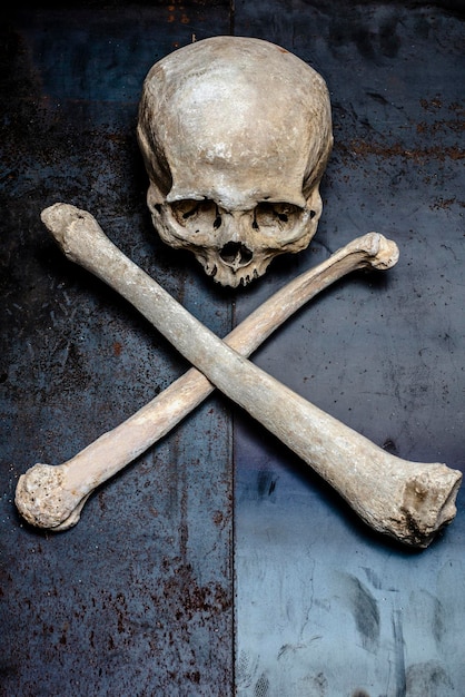 Foto teschio e ossa della coscia su un metallo