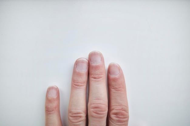 slordige lange mannelijke nagels op een lichte achtergrond mannen arm hebben nagelverzorging nodig mannelijke manicure concept