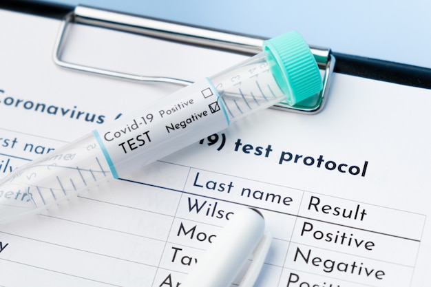 Foto sluit negatieve covid-19 reageerbuis en medisch testprotocol.