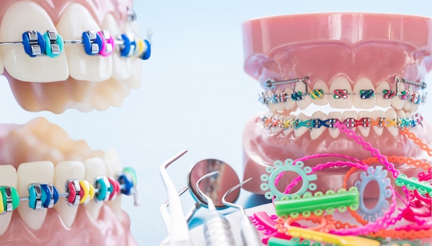 Sluit omhoog tandartshulpmiddelen en orthodontisch model