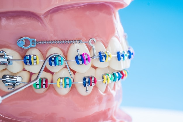 Sluit omhoog tandartshulpmiddelen en orthodontisch model