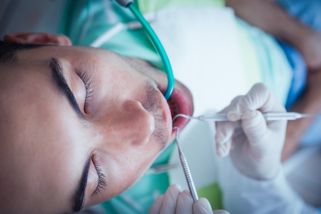 Sluit omhoog van de mens die zijn tanden hebben die door tandarts worden onderzocht