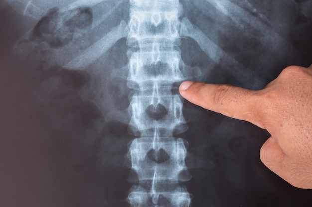 Sluit röntgenbeeld van de mens voor een medische diagnose