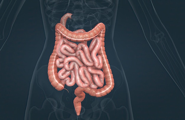 The small bowel connects to the large bowel also called the large intestine or colon