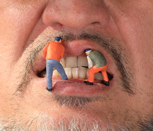 Photo small figure worker cleaning tooth model